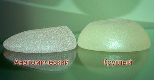 mammoplastika-realizuet-mechti-foto-2