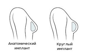 mammoplastika-realizuet-mechti-foto-3